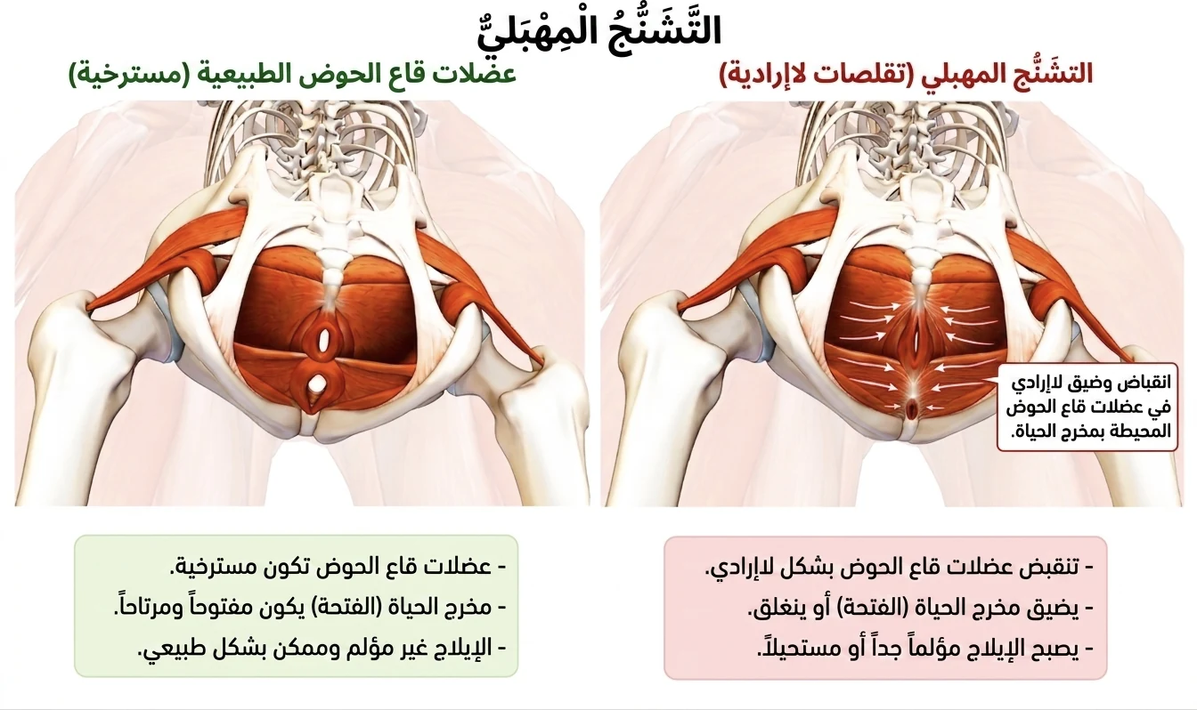 صورة سريرية توضيحية لتشنج المهبل — تقلص لا إرادي في عضلات قاع الحوض يمنع الإيلاج — علاج تشنج المهبل في الرياض، حي العليا، المملكة العربية السعودية — د. دينا رزق، اخصائية التجميل النسائي المعتمدة من IAAUG